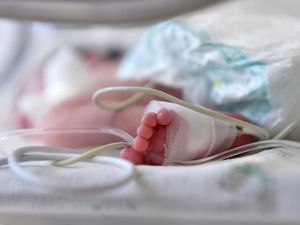 1 dari 4 Balita di RI Alami Anemia, Kenali Tanda-tandanya Sebelum Terlambat