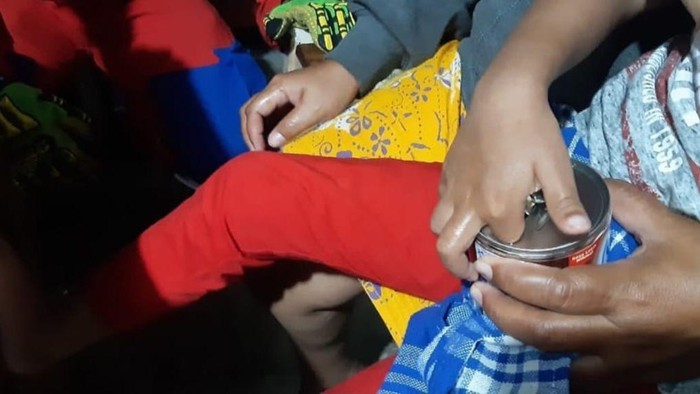 Jari bocah di Jaktim terjepit di lubang kaleng susu