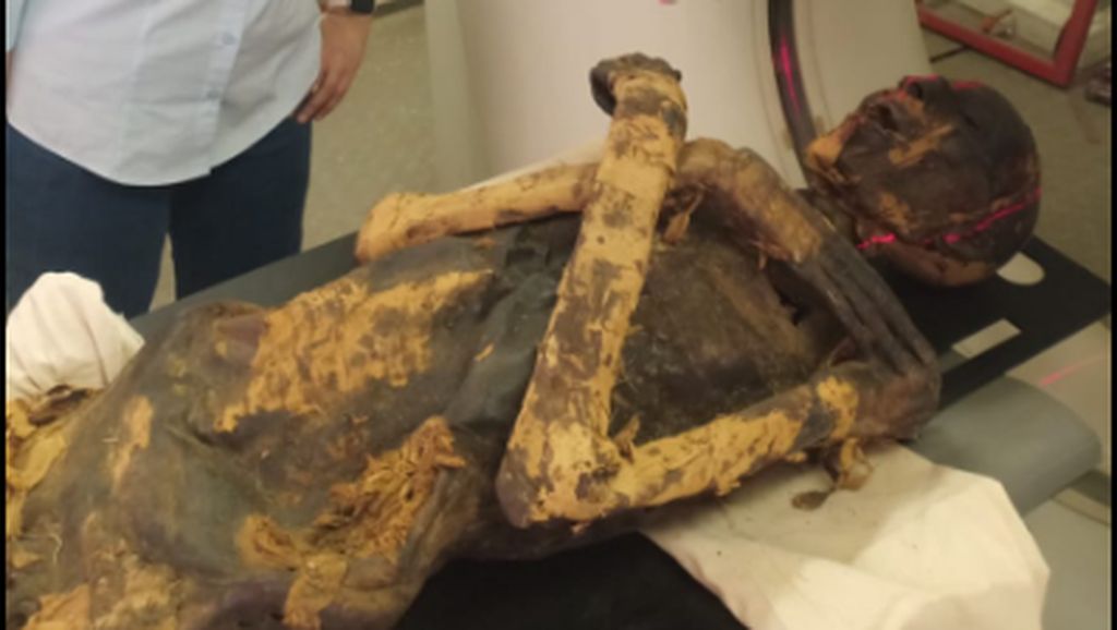 Senjata Paleoradiolog Mesir Sang Pemindai Mumi Para Firaun: CT Scan