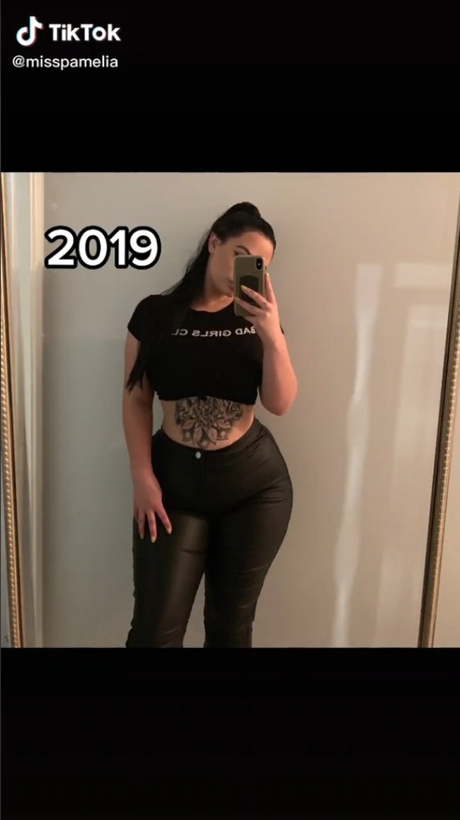 Begini penampilan awalnya ketika belum mengalami pembesaran payudara.Wanita asal Australia itu belakangan aktif di TikTok untuk mengedukasi orang-orang dan meningkatkan kesadaran akan kondisi langka tersebut. Meski cukup tampak percaya diri tampil di media sosial, Pamelia J mengaku merasakan gangguan baik secara fisik maupun mental. Karena sering dipandangi orang di jalan, Pamelia kini lebih banyak memilih untuk tinggal di rumah.Foto: TikTok Pamelia J