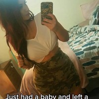 Karena masalah itu, ia sudah mendapat perawatan medis sejak tahun lalu setelah merasakan sakit di bagian punggung, leher, dan pundak. Tapi ia baru-baru ini dirujuk ke dokter bedah setelah ukuran payudara membesar dari ukuran J menjadi M.Foto: TikTok Pamelia J