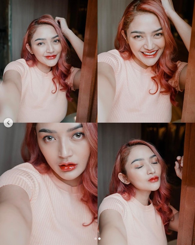 Siti Badriah mengatakan jika untuk bibir dirinya memang melakukan filler. Namun untuk hidung masih asli, tanpa filler dan operasi plastik. Dagunya pun sebelumnya pernah dibuat agar terlihat lebih lancip, namun saat ini diakuinya efek prosedur tersebut sudah hilang. Foto: Instagram/@sitibadriahh