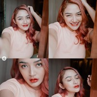 Siti Badriah mengatakan jika untuk bibir dirinya memang melakukan filler. Namun untuk hidung masih asli, tanpa filler dan operasi plastik. Dagunya pun sebelumnya pernah dibuat agar terlihat lebih lancip, namun saat ini diakuinya efek prosedur tersebut sudah hilang. Foto: Instagram/@sitibadriahh