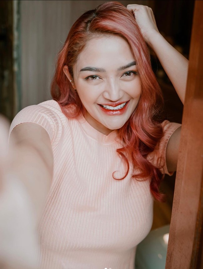 Selain filler bibir agar bibirnya terlihat lebih bervolume, Siti Badriah juga mengaku melakukan veneer pada giginya agar lebih rapih. Selebihnya untuk menjaga kecantikan kulit wajahnya ia melakukan beragam prosedur laser di klinik kecantikan. Foto: Instagram/@sitibadriahh