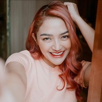 Selain filler bibir agar bibirnya terlihat lebih bervolume, Siti Badriah juga mengaku melakukan veneer pada giginya agar lebih rapih. Selebihnya untuk menjaga kecantikan kulit wajahnya ia melakukan beragam prosedur laser di klinik kecantikan. Foto: Instagram/@sitibadriahh