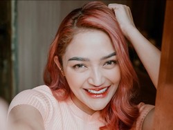 7 Foto Siti Badriah Makin Cantik Dengan Veneer & Filler Bibir, Dituding Oplas