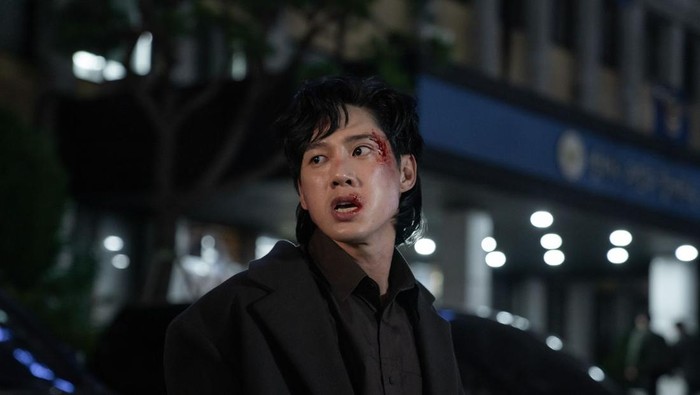 Dialami Jeon Jae Joon di The Glory, Apa Itu Penyakit Glaukoma?