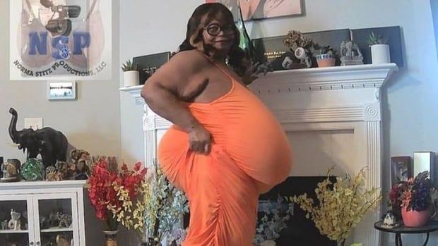 Kisah wanita pemegang rekor payudara terbesar di dunia.