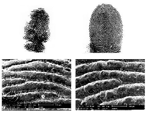 Jejak tinta sidik jari koala jantan dewasa (kiri) dan laki-laki dewasa (kanan). Bawah: hasil pindai epidermis yang melapisi ujung jari masing-masing koala dan manusia tersebut.
