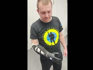 Kecanggihan Lengan Bionik untuk Tentara Ukraina