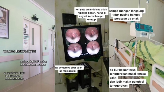 Viral TikTok kisah wanita kena radang amandel, benarkah gegara minuman manis?