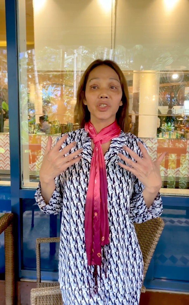 Walaupun bagian matanya terlihat masih sedikit lebam namun Bunda Corla sudah berani tampil percaya diri memamerkan wajah barunya. Bagaimana menurutmu penampilan baru Bunda Corla? Foto: Instagram/@corla_2