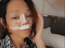 7 Transformasi Bunda Corla yang Operasi Plastik Hidungnya Sebelum Mudik ke RI