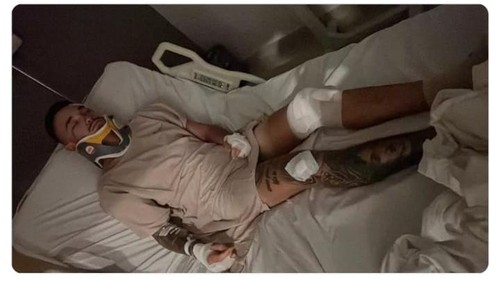 Viral Bule Australia Babak Belur Kena Jambret, Polisi: Tak Ada Laporan