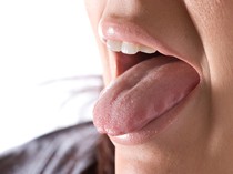 Lidah Terasa Kasar dan Muncul Warna Putih Pekat, Apa Pemicunya Dok?