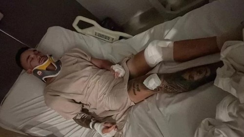 Bule Australia dirampok dan dipukuli di Bali