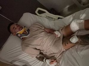 Brian Hunt, Bule Australia yang Heboh Dirampok Ternyata Kecelakaan