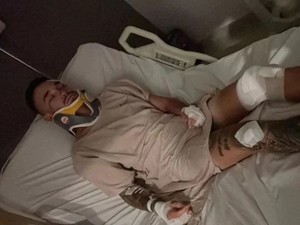 Bule Jatuh dari Motor Ngaku Dirampok dan Dipukuli di Bali Galang Dana Bantuan