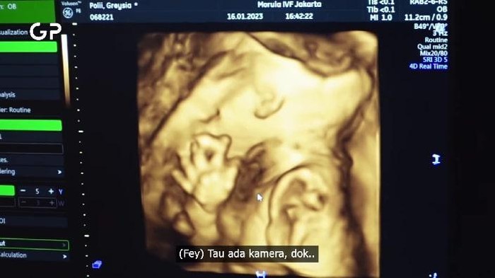 Momen Greysia Polii Pamer Hamil Anak Pertama Usai Pensiun Jadi Atlet