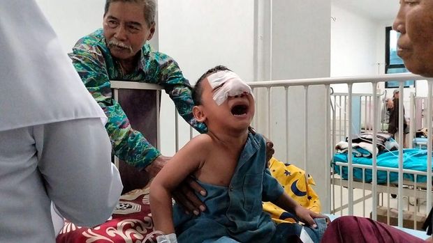 Kabar baik datang dari Dilan, pejuang tumor hidung di Lampung. Pada 27 Desember lalu, ia berhasil melalui operasi kedua untuk merekontruksi hidung akibat tumor.