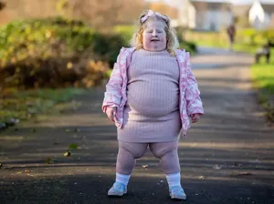 Viral Bocah 5 Tahun Tak Bisa Berhenti Makan, BB-nya Sudah 45 Kg