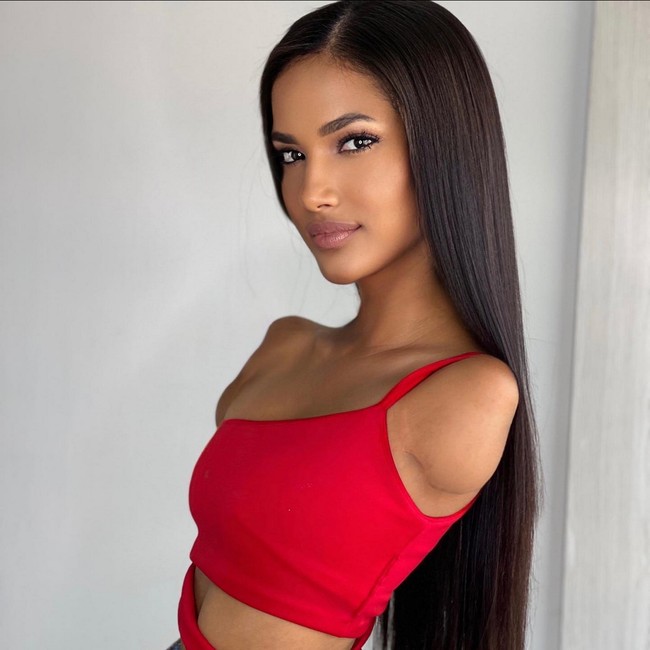 Mengalami luka bakar parah, dokter harus mengamputasi kedua tangan dan kaki kirinya demi menyelamatkan nyawanya. Foto: Instagram/@vicco_salcedo