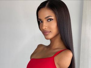 Kisah Wanita dengan Satu Kaki dan Tanpa Lengan Sukses Raih Mimpi Jadi Model