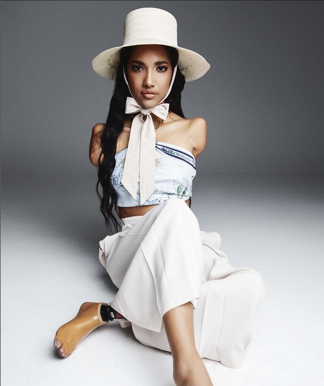 Hidup dalam keterbatasan tak membuat Victoria menyerah. Dia tetap berusaha jadi wanita mandiri dengan melatih kaki kanannya yang masih utuh untuk melakukan berbagai aktivitas seperti pakai baju, berdandan hingga merapikan rambut. Foto: Instagram/@vicco_salcedo