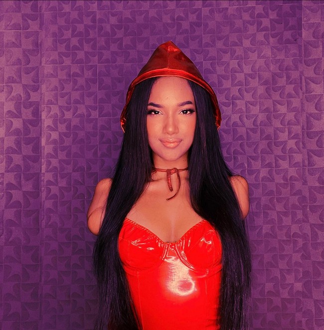 Victoria Salcedo harus kehilangan tangan dan kaki kirinya di usia 6 tahun akibat kecelakaan listrik. Foto: Instagram/@vicco_salcedo