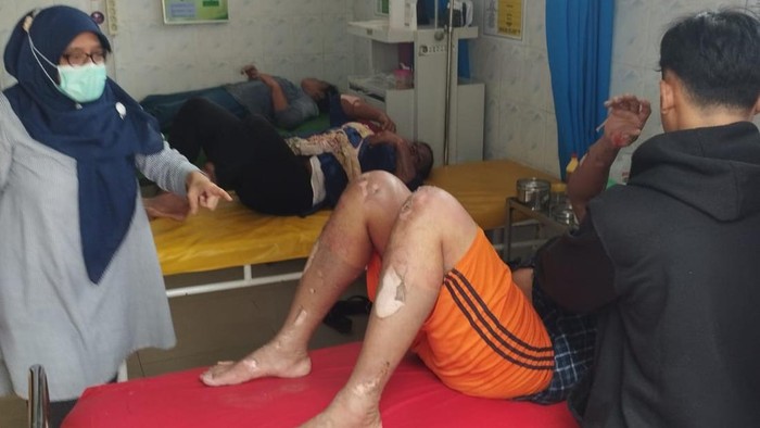 3 pekerja kafe yang dilarikan ke Puskesmas akibat terkena ledakan tabung gas (Foto: Istimewa)