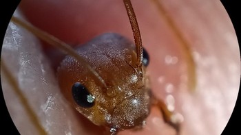 Hasil kamera mode mikroskop. Foto: Adi Fida Rahman/detikINET  