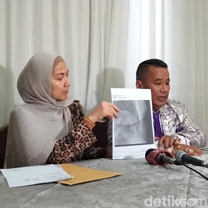 Venna Melinda saat menggelar konferensi pers bersama Hotman Paris, penasihat hukunmnya