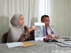 Venna Melinda Tunjukkan Bukti Kuatkan Pengakuan Rusuk Retak Ulah Ferry Irawan