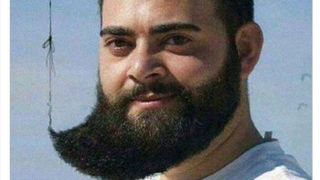 Rambut dan janggutnya tersambung rambut tipis. Foto: f**ked_up_hair via Bored Panda