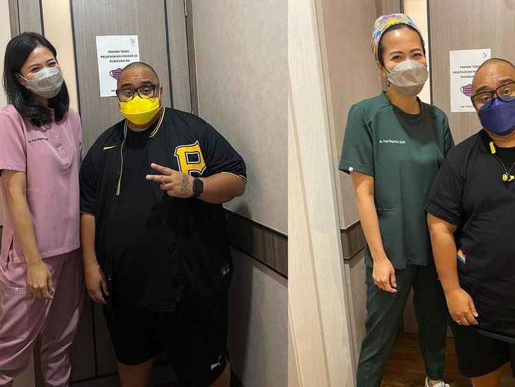 Before-After Saykoji Sukses Pangkas BB 20 Kg dalam 4 Bulan
