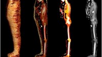 Sahar N Saleem dkk dari Fakultas Kedokteran Kasr Al Ainy, Universitas Kairo Mesir dan Museum Mesir Kairo, berhasil menggunakan CT-scan untuk meneliti mumi tanpa merusaknya. Teknologi ini memungkinkan pembukaan mumi secara berlapis, mulai dari yang terbungkus kain, tubuh yang tidak terbungkus kain, kerangka dan jaringan lunak yang tersisa, dan kerangkanya saja. Foto: © Sahar N. Saleem, Sabah Abd el-Razek Seddik, dan Mahmoud el-Halwagy 