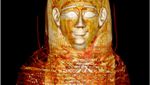 Potret Mumi Remaja dengan 49 Jimat Via Teknologi CT-scan