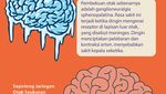 Infografis: Menakjubkan! 10 Fakta Sains tentang Otak Manusia
