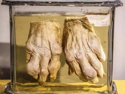 Deretan Foto Jadul yang Aneh Bikin Terperangah Mengetahui Faktanya