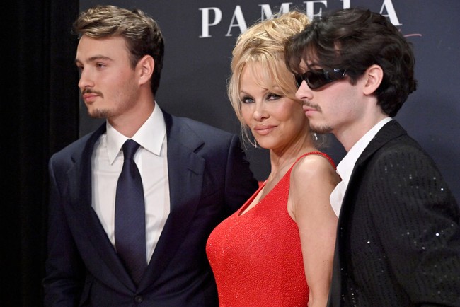 Dylan Jagger Lee awalnya mengungkapkan kekecewaannya pada pihak Hulu yang memproduksi serial Pam & Tommy. Seri drama tersebut mengisahkan kehidupan pernikahan Pamela Anderson dan Tommy Lee khususnya di masa keduanya membuat video seks yang viral ke publik. “Kenapa mengangkat sesuatu dari 20 tahun lalu yang kamu tahu itu menghancurkan hidup orang?” ucap Dylan emosi.  Foto: Getty Images
