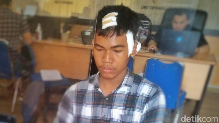Korban pembacokan gegara dituding rebut pacar orang di Palembang saat melapor di Polrestabes. (Prima Syahbana/detikSumut)