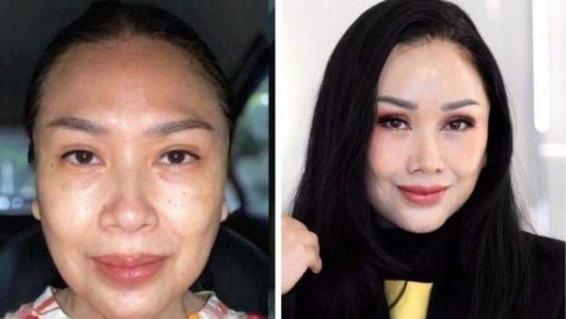 Penyanyi diva Indonesia Titi DJ baru-baru ini membagikan pengalamannya melakukan operasi anti aging atau anti penuaan di Gangnam, Korea Selatan pada 6 Januari lalu. (Tangkapan layar instagram @ti2dj)