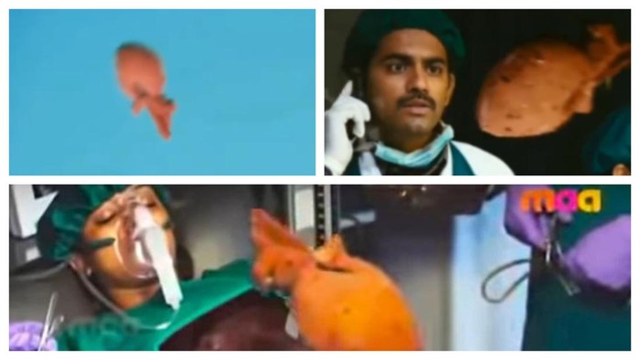 Film parodi dari Telugu, India, menampilkan adegan transplantasi jantung yang dilakukan dengan cara super atraktif dan tidak biasa. Netizen ramai berkomentar.