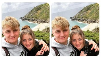 Akibat minta jarinya dipisahkan, hasilnya ekstrim. Foto: Instagram/James Fridman