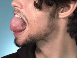 Potret Orang dengan Ciri Fisik Luar Biasa Bikin Kaget Tak Percaya