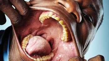 Perkenalkan Francisco Domingo Joaquim, orang yang secara resmi memiliki mulut berukuran 17 cm saat tidak diregangkan. Foto: Guinness World Records