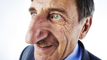 Bagi sebagian orang, hidung besar bisa menjadi alasan ketidakamanan, namun bagi Mehmet Özyürek, hidungnya menjadi ciri unik yang membuatnya terkenal. Özyürek memiliki hidung terpanjang , berukuran 8,80 cm. Dia tidak pernah merasa perlu untuk mengubahnya dan selalu senang memilikinya. Foto: Brightside