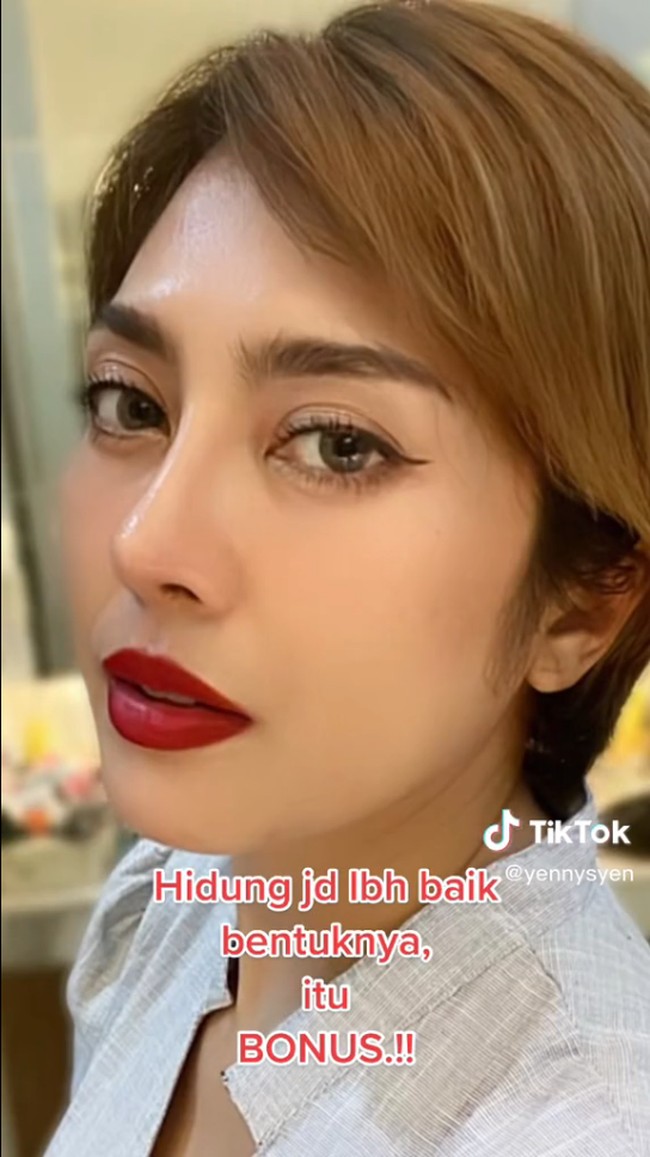 Begini perbedaan hidungnya ketika sudah pulih total.Foto: Instagram/TikTok @yennysyen