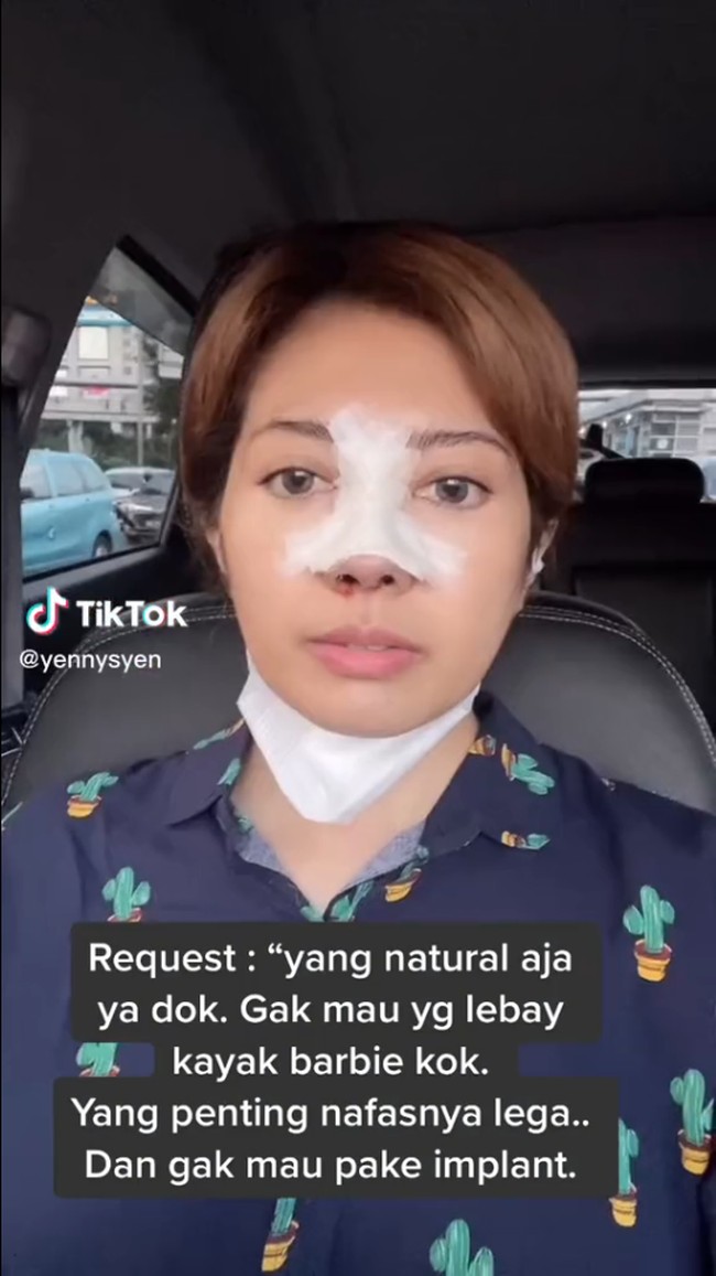 Dalam foto terlihat wajahnya dengan hidungnya diperban. Meski dalam masa penyembuhan, Yenny terlihat tetap bisa beraktivitas.Foto: Instagram/TikTok @yennysyen
