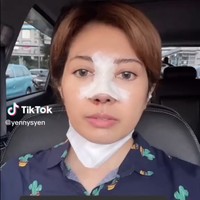 Dalam foto terlihat wajahnya dengan hidungnya diperban. Meski dalam masa penyembuhan, Yenny terlihat tetap bisa beraktivitas.Foto: Instagram/TikTok @yennysyen